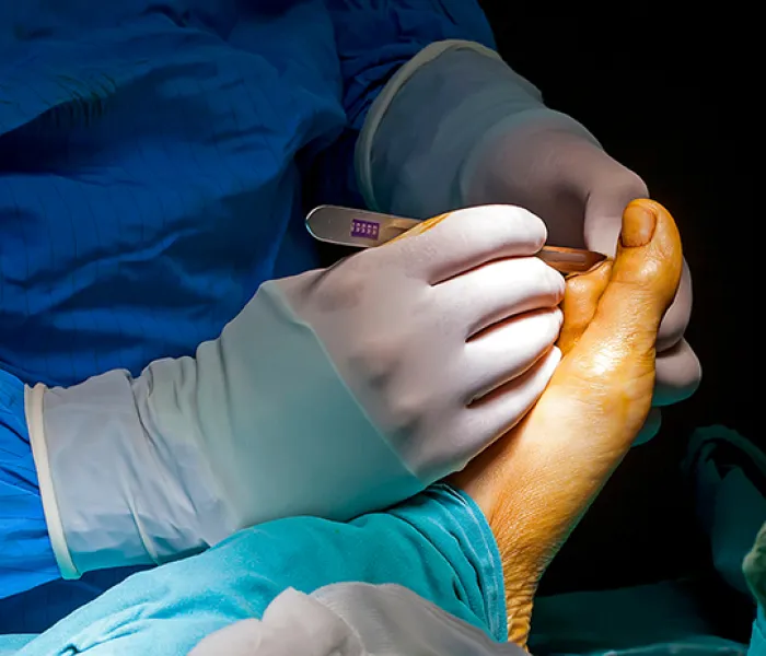 Programa de desarrollo profesional permanente en cirugía de pie y tobillo Programa de desarrollo profesional permanente en cirugía de pie y tobillo